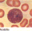 eosinófilo