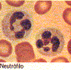 neutrófilo (segmentado) 